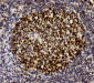 MSH2 Antibody (Center)